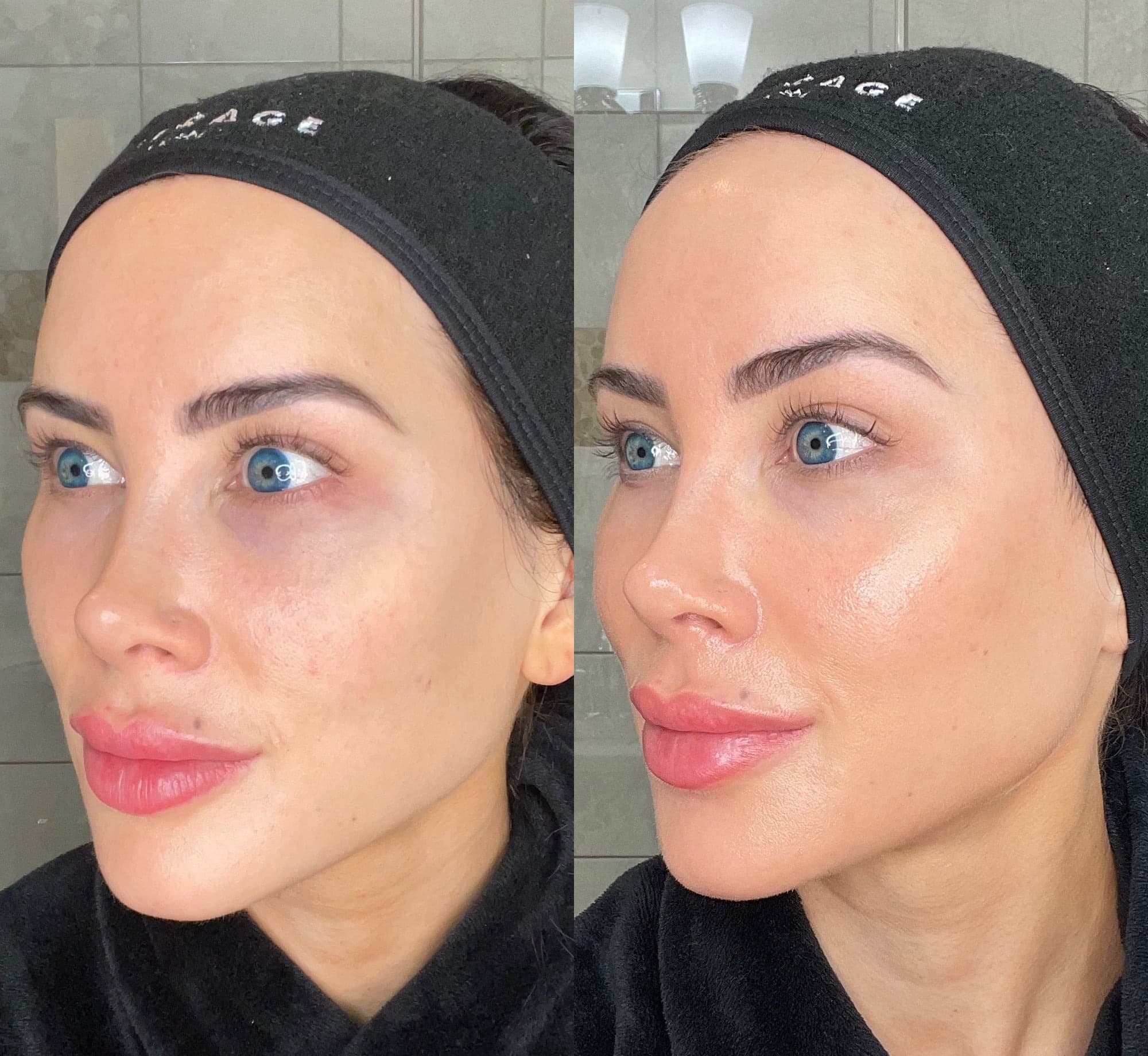 Average Baseline — CELESTA