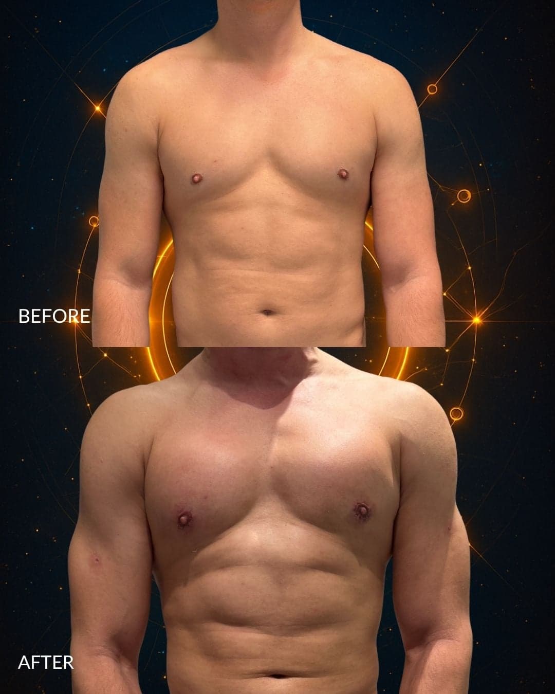 MAXORIS Body Sculpting — before and after